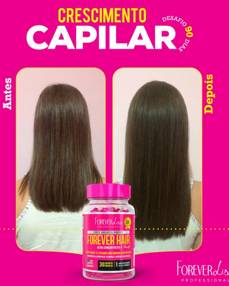 Forever Hair Crescimento Capilar Tratamento 30 Dias