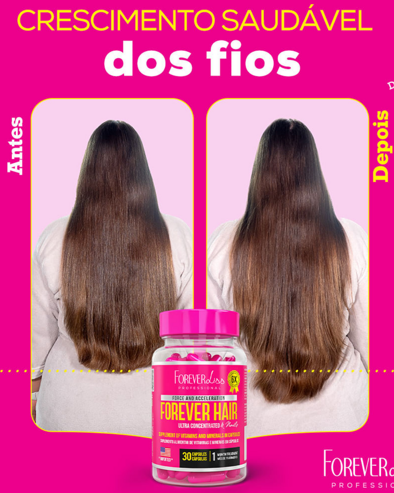 Forever Hair Crescimento Capilar Tratamento 30 Dias